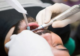 بهترین دندانپزشک اصفهان جراحی دندان