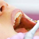 بهترین دندانپزشک اصفهان درمان ریشه