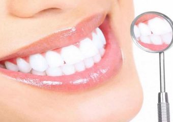 دوام بليچينگ يا سفيدكردن دندانها