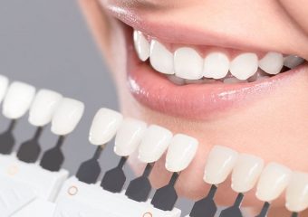 دوام ونير كامپوزيت و لامينيت سراميكی