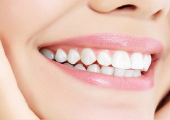 طراحی لبخند چه مشکلاتی را اصلاح می کند؟