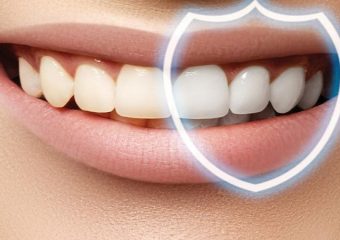 مراقبت های بعد از جرم گیری دندان