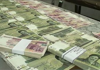 هزینه لمینیت دندان