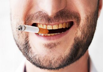 ایمپلنت برای افراد سیگاری چگونه است؟