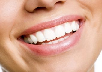 بهترین دندانپزشک اصفهان |اهمیت طراحی لبخند