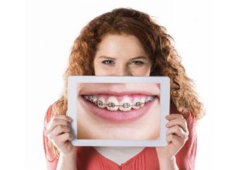 بهترین ایمپلنت اصفهان | چرا با داشتن درمان ارتودنسی دندان نباید سیگار کشید ؟