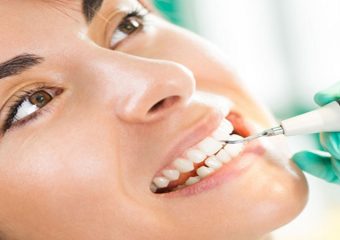 بهترین ایمپلنت اصفهان |چه کسانی می توانند از ونیر دندان استفاده کنند ؟