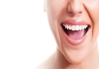 بهترین ایمپلنت اصفهان |بررسی روش های کاشت ایمپلنت برای افراد مبتلا به دیابت