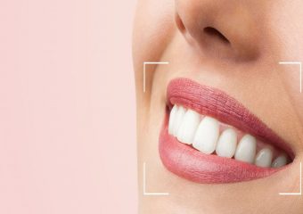 بهترین دندانپزشک اصفهان | طراحی لبخند