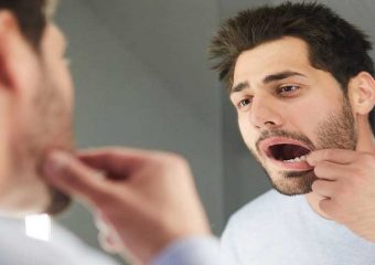 بهترین دندانپزشک اصفهان | لق شدن دندان