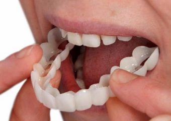 انواع پروتز دندان و عوارض آن | بهترین ایمپلنت اصفهان