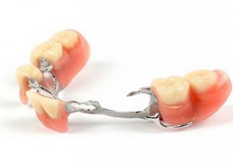 پروتز دندانی متحرک چیست؟ | بهترین ایمپلنت اصفهان