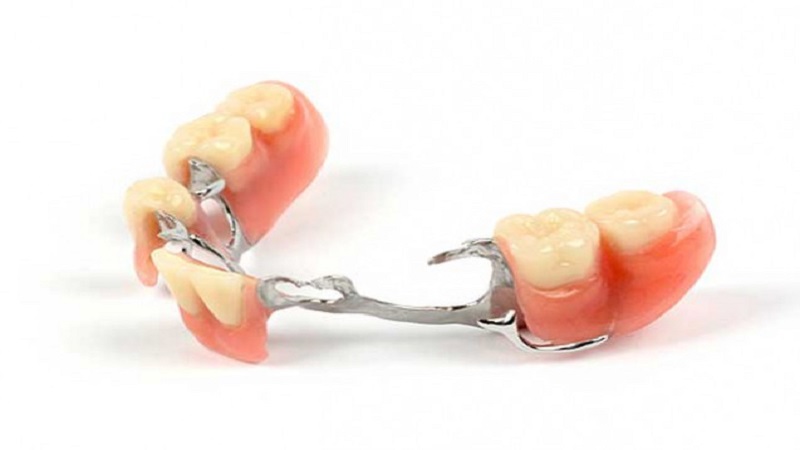 پروتز دندانی متحرک چیست؟ | بهترین ایمپلنت اصفهان