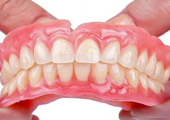 پروتز کامل دندان | بهترین ایمپلنت اصفهان