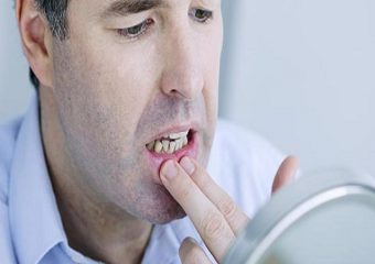 بهترین ایمپلنت اصفهان | جلوگیری از سستی و شل شدن دندان ها