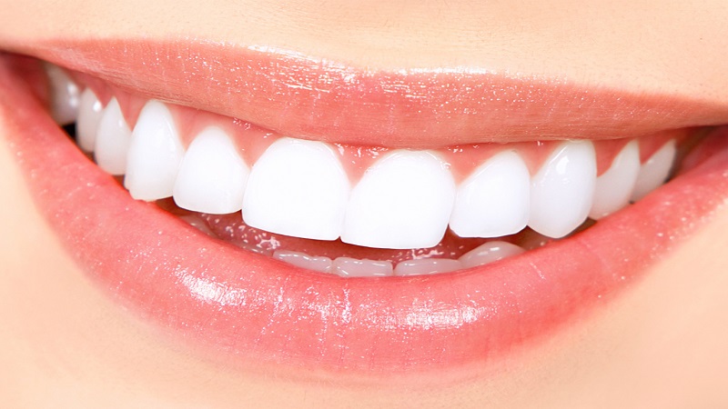 بهترین ایمپلنت اصفهان | سفید کردن دندان ها