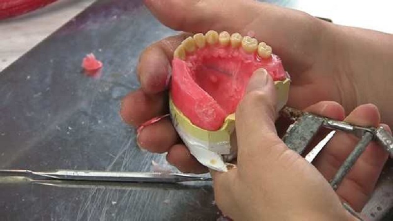 چگونگی ساخت پروتز دندان | بهترین ایمپلنت اصفهان
