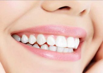 مراقبت از مینای دندان | بهترین ایمپلنت اصفهان