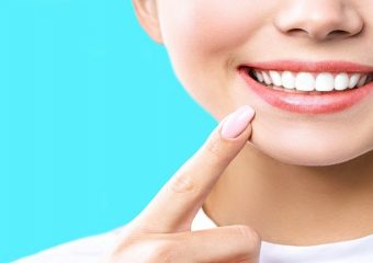 بهترین دندانپزشک اصفهان | وایتینگ دندان ها قبل و بعد از بریس