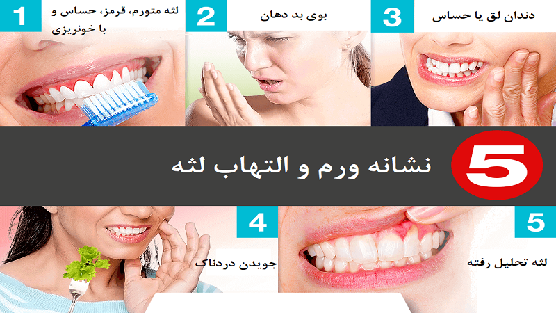 عوامل اصلی ایجاد کننده التهاب و عفونت لثه | بهترین دندانپزشک اصفهان