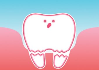 اقدامات لازم برای تروما در دندانهای شیری | بهترین دندانپزشک اصفهان