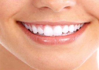 فواید فلوراید و سلامت دندان | بهترین دندانپزشک اصفهان