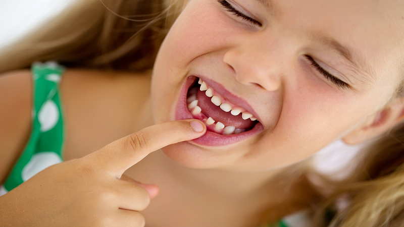 افتادن دندان‌های شیری | بهترین ایمپلنت اصفهان