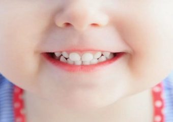 تاثیر شیر مادر بر سلامت دندان کودکان | بهترین ایمپلنت اصفهان