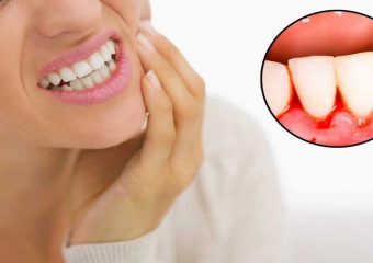 عفونت لثه و افزایش نقص شناختی | بهترین دندانپزشک زیبایی اصفهان