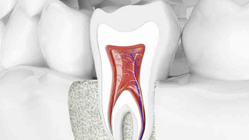 عوامل موثر در آسیب پالپ | بهترین ایمپلنت اصفهان