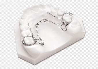 فضا نگهدارنده چیست؟ | بهترین ایمپلنت اصفهان