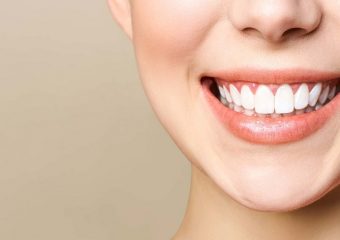 افزایش دوام ایمپلنت دندان | بهترین ایمپلنت اصفهان