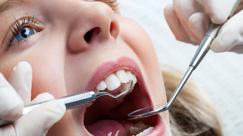 بررسی کامل روکش دندان | بهترین ایمپلنت اصفهان