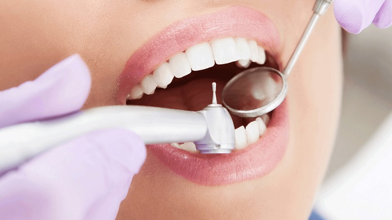 بیماری های دهان و دندان بزرگسالان و کودکان | بهترین دندانپزشک اصفهان