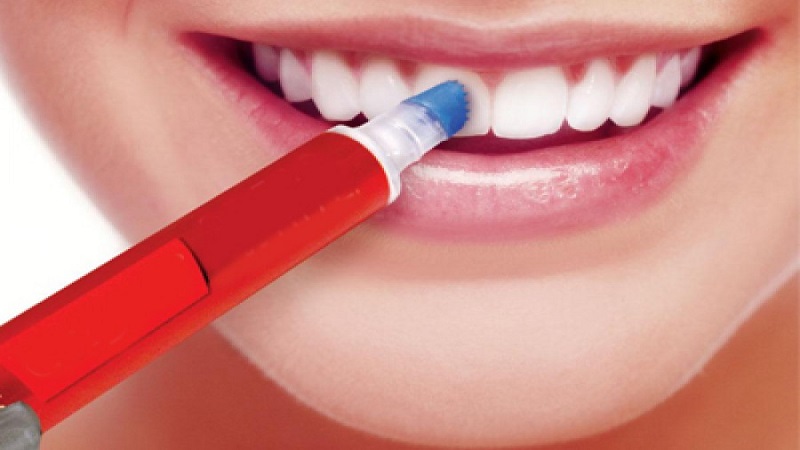 عوارض کیت و محصولات سفید کننده دندان | بهترین ایمپلنت اصفهان