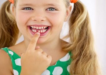 پیشگیری از بیماری های دندان در کودکان | بهترین دندانپزشک اصفهان