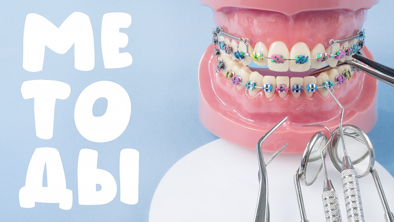 اتصال دستگاه های ارتونسی درد دارد؟ | بهترین دندانپزشک زیبایی