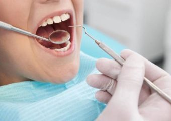 آنچه باید در مورد درمان ریشه دندان بدانید | بهترین دندانپزشک اصفهان