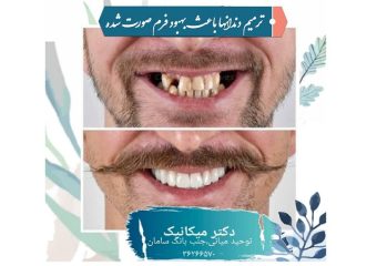 ترمیم دندان ها و اصلاح فرم صورت | بهترین دندانپزشک اصفهان