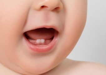 راه های کاهش درد دندان آوردن در نوزادان | بهترین ایمپلنت اصفهان