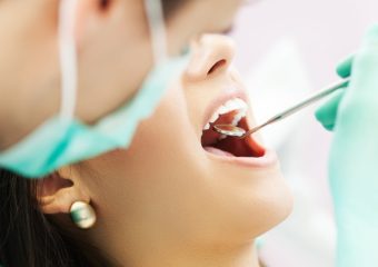 نحوه انجام عصب‌کشی توسط متخصص اندو | بهترین ایمپلنت اصفهان