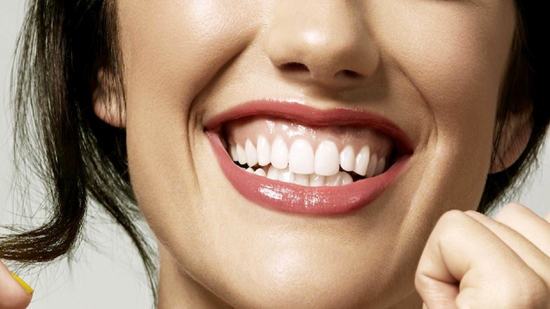 روش های از بین بردن فاصله دندان بدون ارتودنسی | بهترین دندانپزشک زیبایی اصفهان