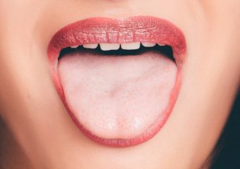 علل و علائم سندرم سوزش دهان | بهترین ایمپلنت اصفهان