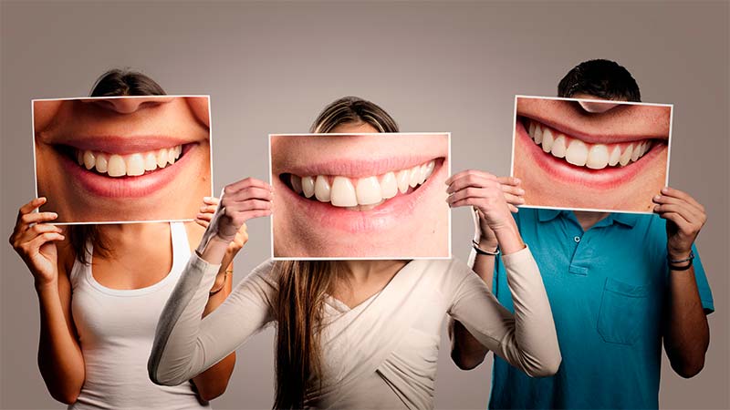 مراحل بلیچینگ دندان در مطب دندانپزشکی | بهترین دندانپزشک زیبایی اصفهان