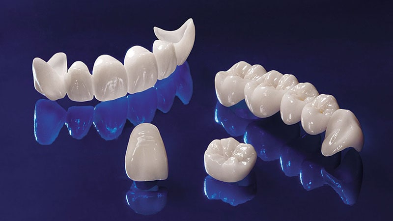 حداقل سن مناسب کامپوزیت دندان | بهترین دندانپزشک اصفهان