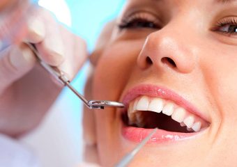 عوامل و ترمیم شکستگی دندان | بهترین دندانپزشک اصفهان