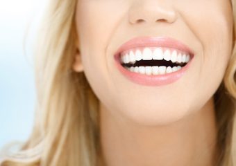 بهترین ایمپلنت اصفهان | بهترین دندانپزشک زیبایی اصفهان | دکتر ندا مکانیک | روش های درمان و اصلاح لبخند لثه ای | بهترین دندانپزشک اصفهان