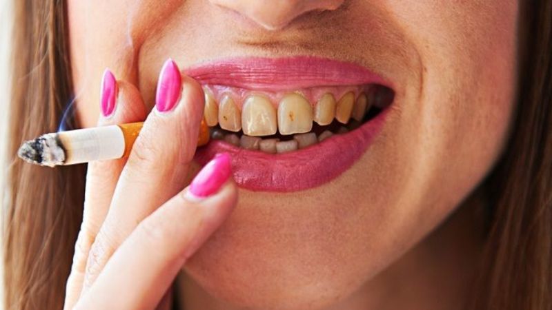 عوامل خطرزا در پوسیدگی دندان | بهترین ایمپلنت اصفهان