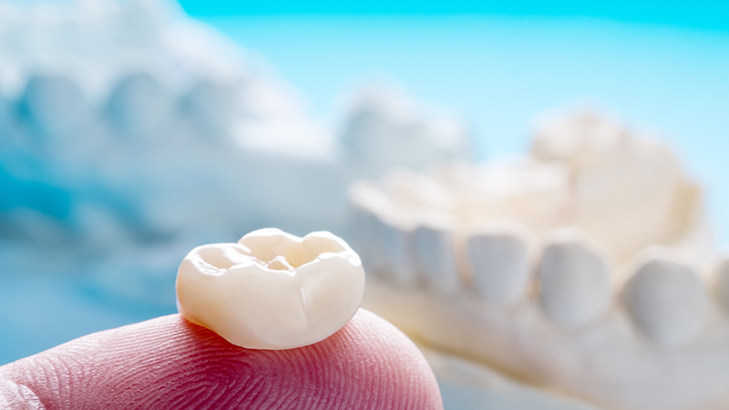 کاربردهای تاج دندان مصنوعی چیست؟ | بهترین دندانپزشک اصفهان