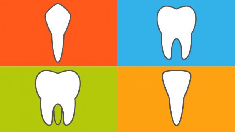 بیلداپ یا بازسازی دندان چیست؟ | بهترین ایمپلنت اصفهان